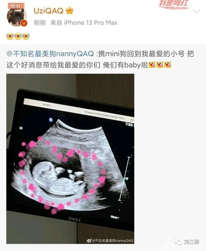 Uzi女朋友怀孕，粉丝称之为：神子降临，分析夏季赛转会消息总汇
